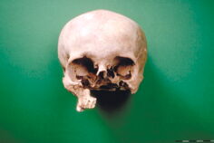 003_CH_FR_Gletterens_Schädel-vorne